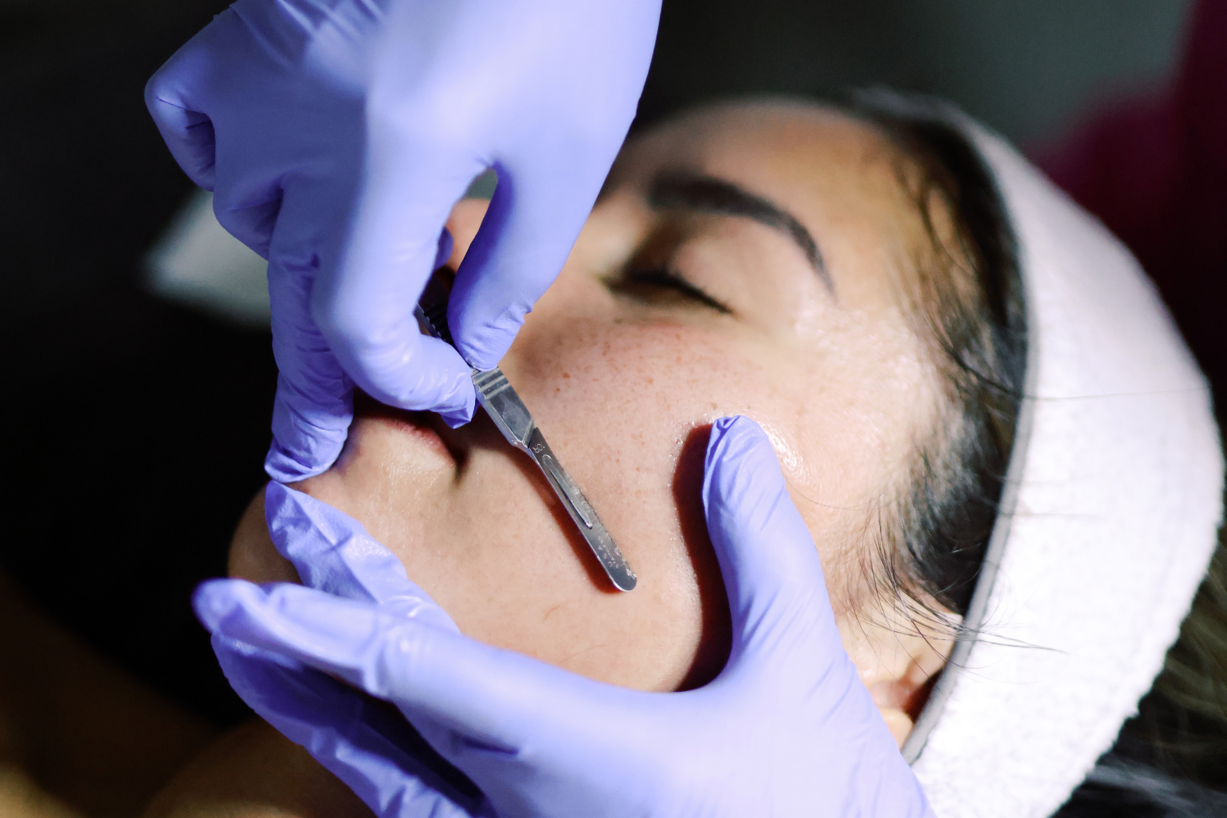 Dermaplane Facial: Myths, Facts, and What You Really Need to Know