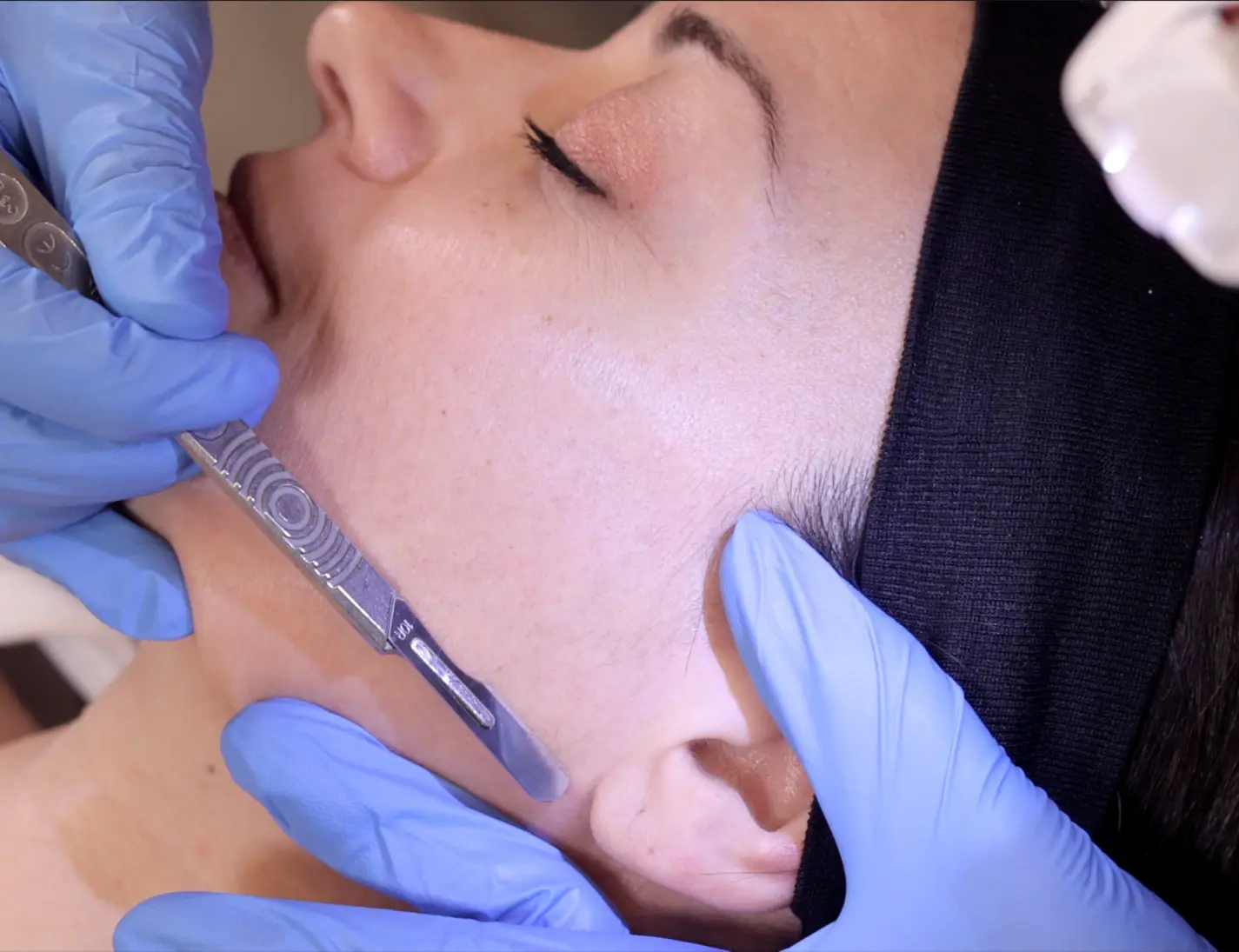 Glow &amp; Go: Advanced Face Treatments for Radiant Skin
