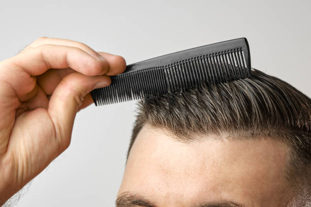 How Much Is Hair Transplant for 4000 Grafts?